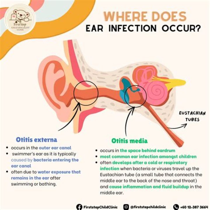 How can I treat an ear infection myself?