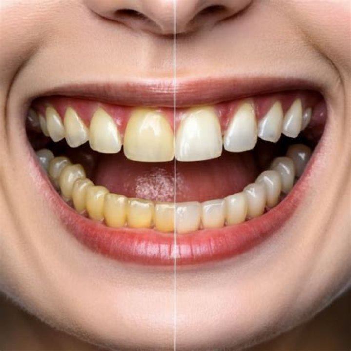 How can I whiten my yellow teeth naturally?