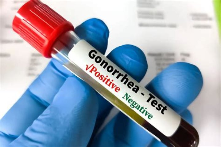 How can you test for gonorrhea at home?