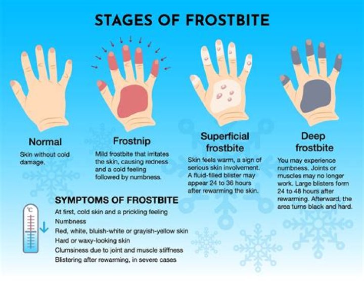How cold does it have to be for a dog to get frostbite?