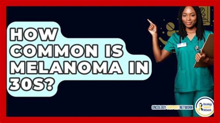 How common is melanoma in 30s?
