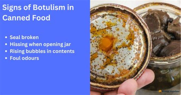 How do dented cans cause botulism?