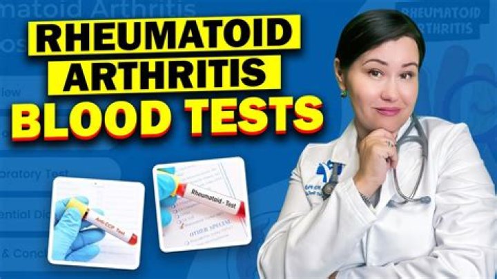 How do doctors test for arthritis?