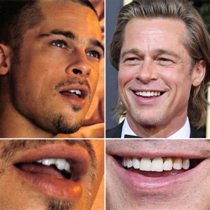 How do Hollywood stars have perfect teeth?