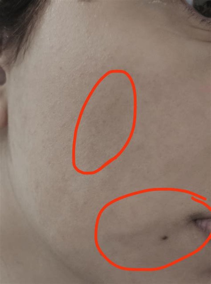 How do I even out my skin tone?