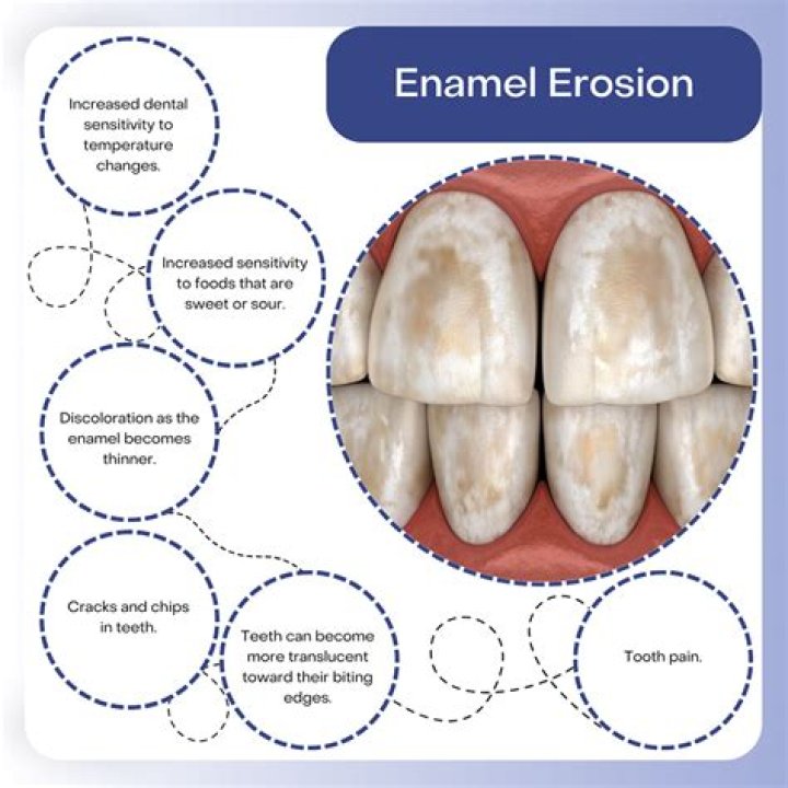 How do I know if my tooth enamel is gone?
