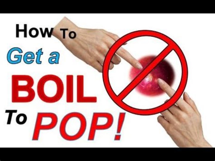 How do u pop a boil?
