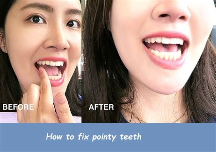 How do you fix pointy ears without surgery?
