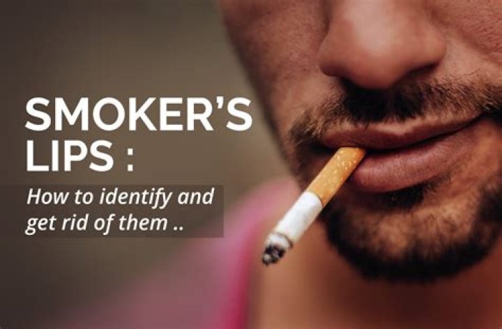 How do you fix smokers lips?