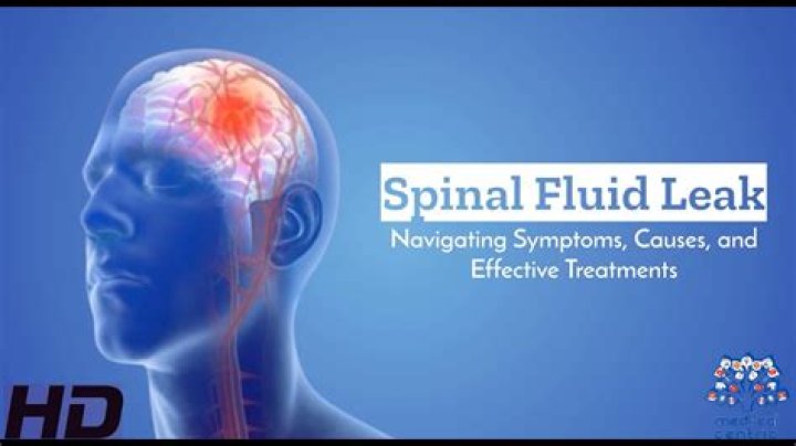 How do you know if you have a spinal fluid leak?