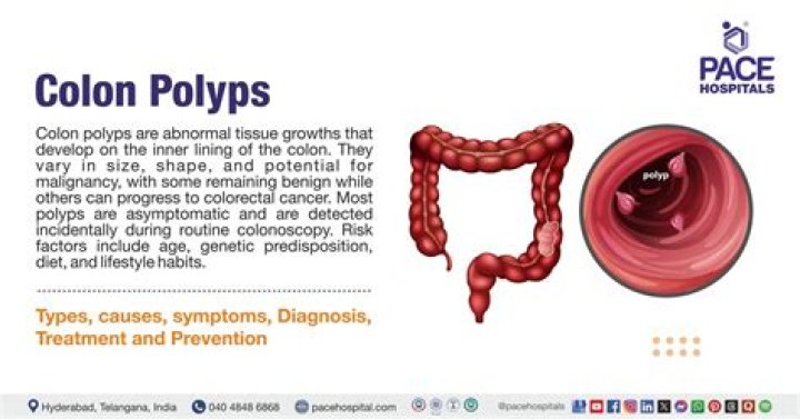 How do you know if you have polyps in your colon?