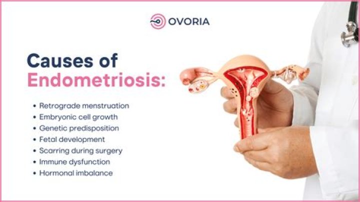 How do you know when endometriosis is back?