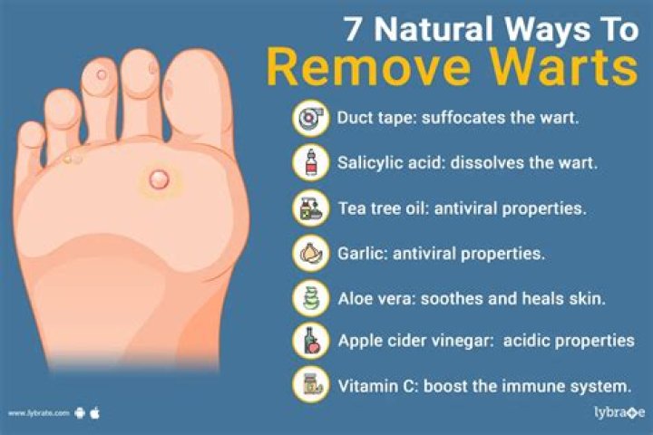 How do you prevent warts on your feet?