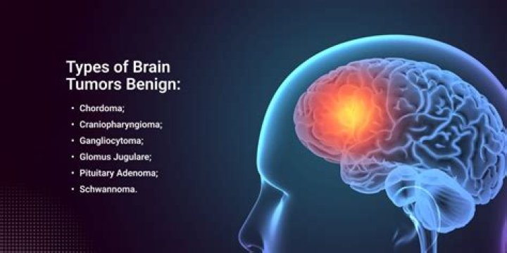How do you shrink a benign tumor?