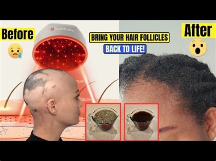 How do you stimulate a dead hair follicle?