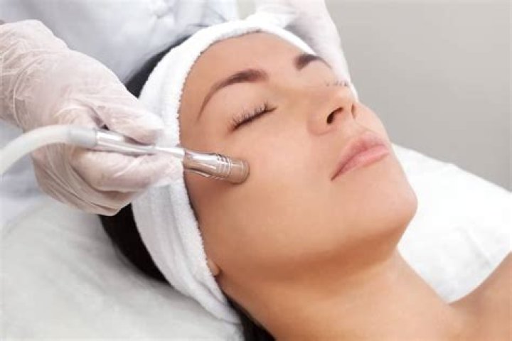 How effective is microdermabrasion for wrinkles?