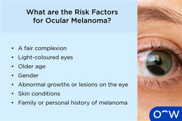 How fast does ocular melanoma spread?