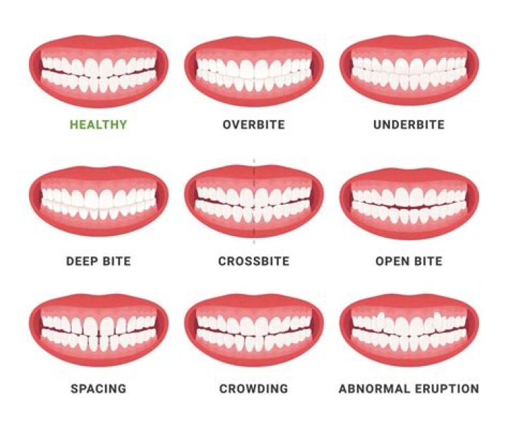 How long are human teeth supposed to last?