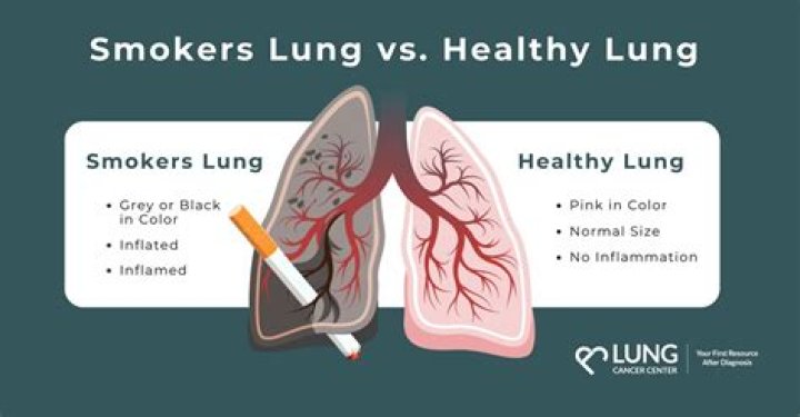 How long can a smoker live?