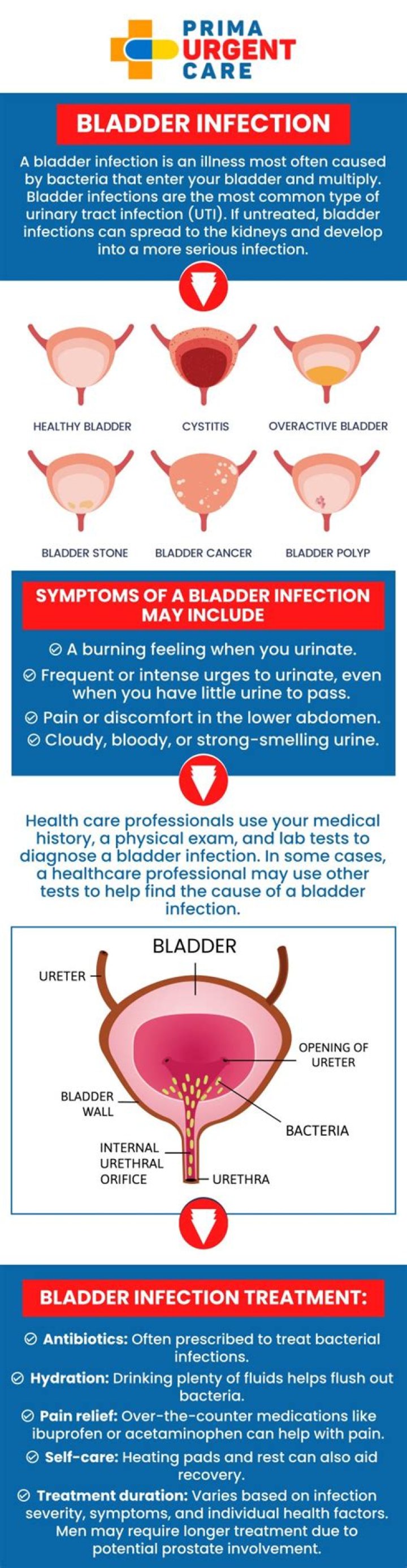 How long does a bladder infection last?