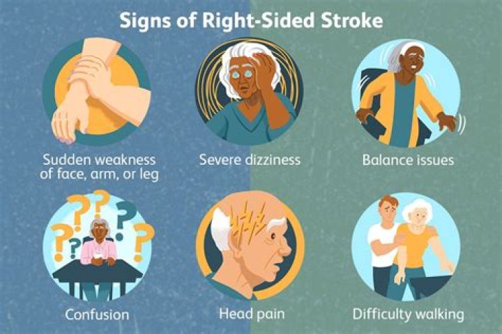 How long does disorientation last after stroke?