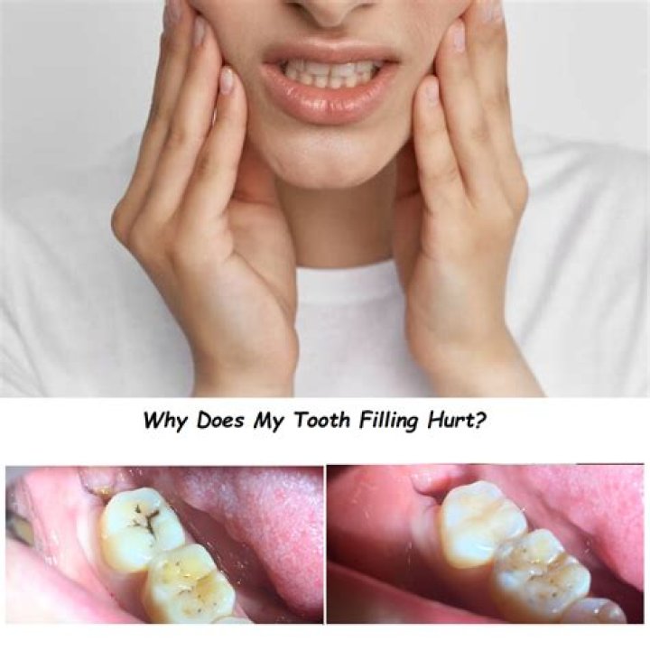How long does it hurt after having all your teeth pulled?