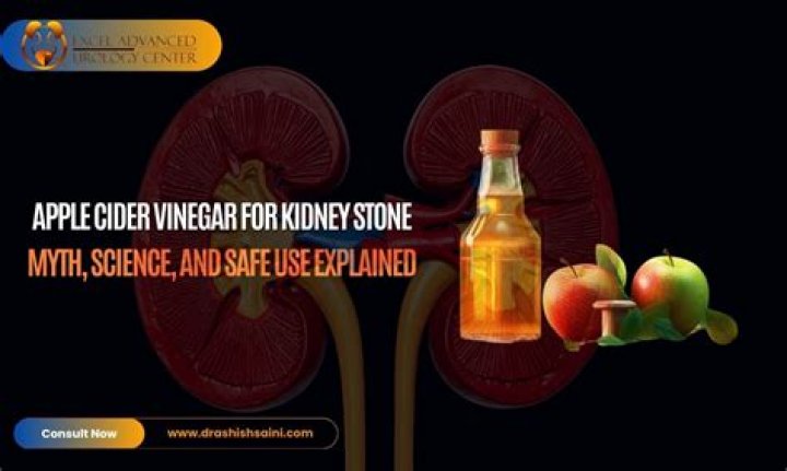 How long does it take apple cider vinegar to remove kidney stones?