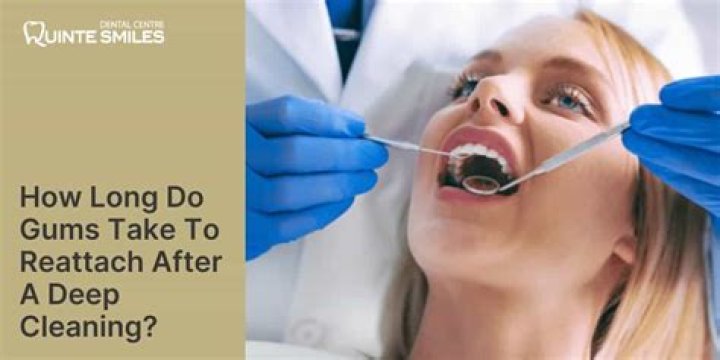 How long does it take for gums to reattach after deep cleaning?