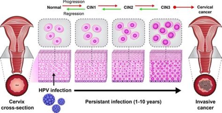 How long does it take for HPV to turn into precancerous cells?