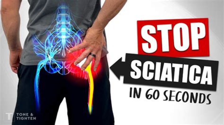 How long does it take for sciatica nerve to heal?