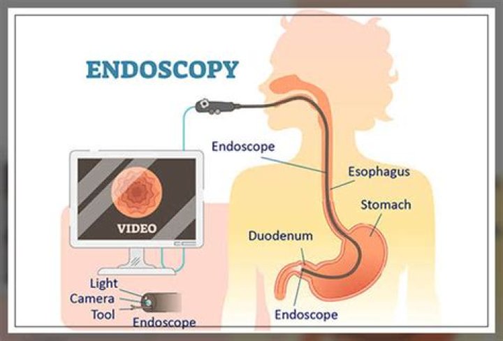 How long does it take to get results from an endoscopy biopsy?