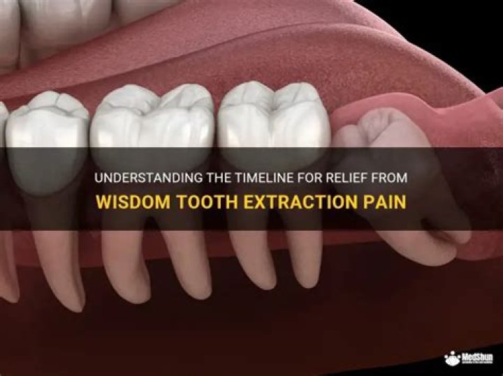 How long does wisdom teeth pain last?