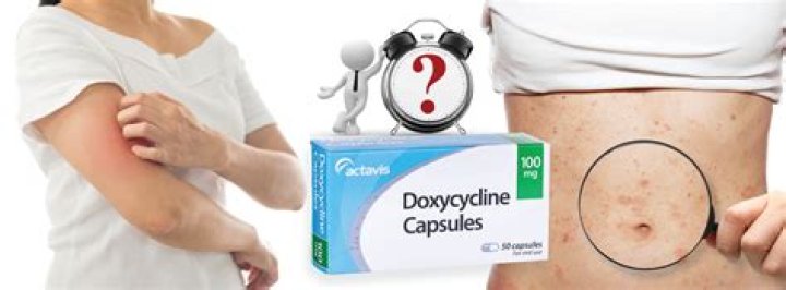 How long should I wait after eating to take doxycycline?