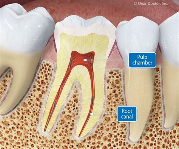 How many root canals can you have on one tooth?