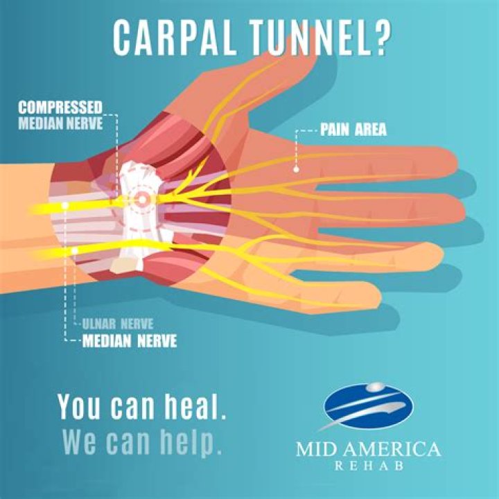 How many times a day should you do carpal tunnel exercises?