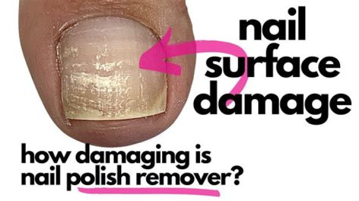 How much damage does the dream nail do?