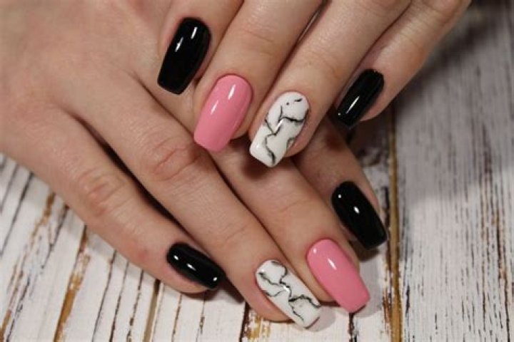 How much does it cost to get toenails removed?