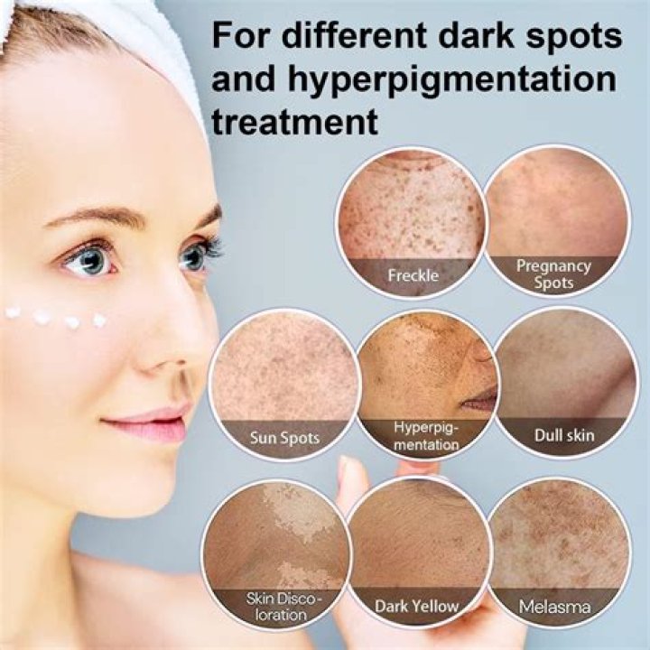 How remove dark spots face?