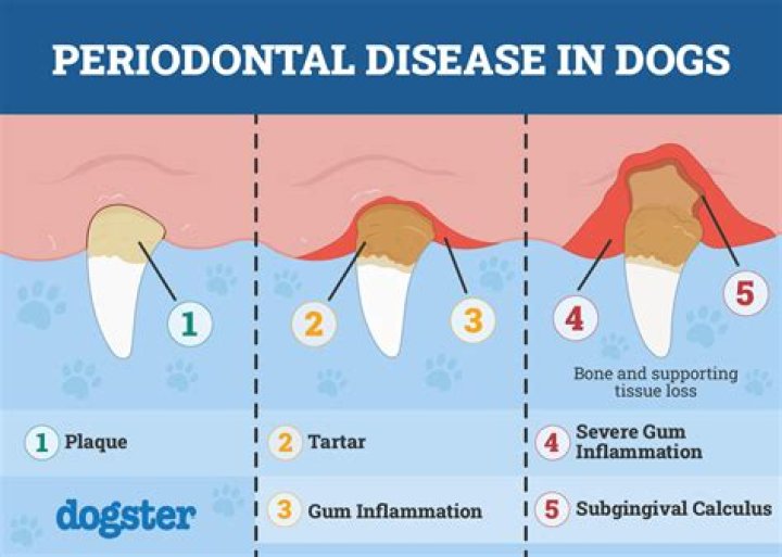 How urgent is a periodontal abscess?
