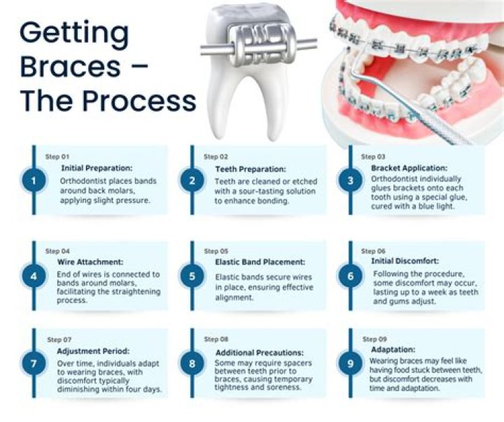 Is 4 years of braces too long?