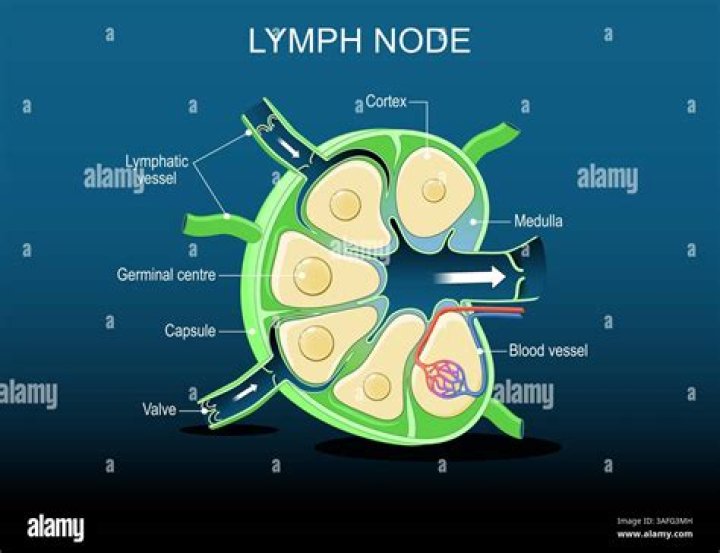 Is a 2 cm lymph node big?