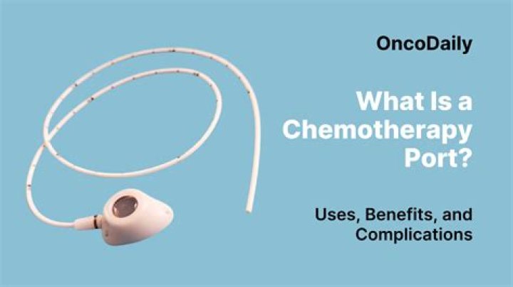 Is a chemo port uncomfortable?