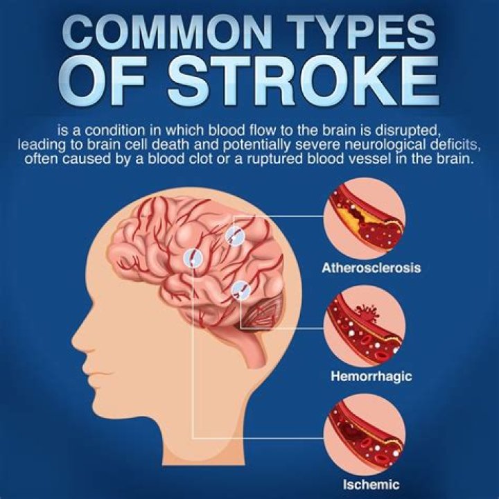 Is a stroke painful?