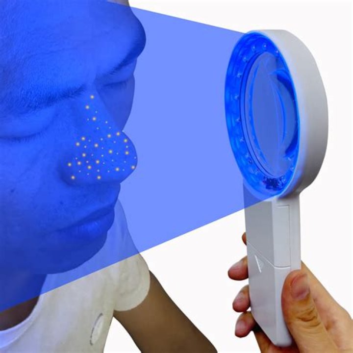 Is a Woods Lamp a black light?