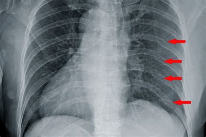 Is all mail Xrayed?