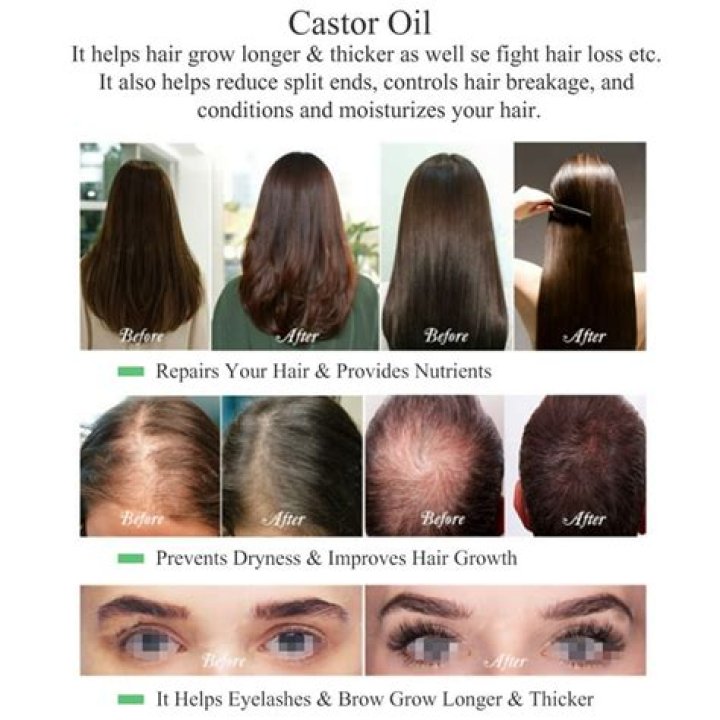 Is castor oil good for thin hair?