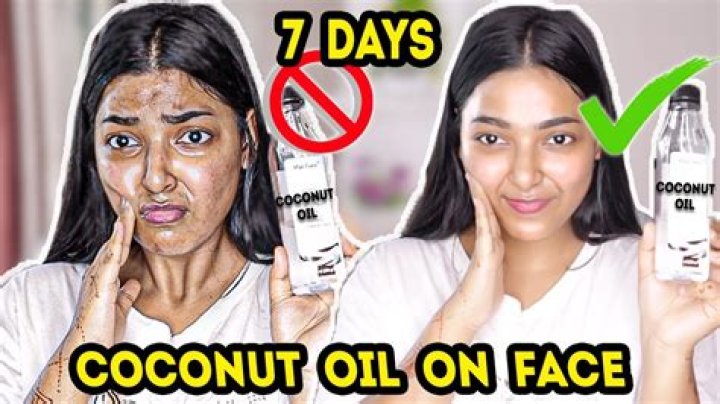 Is coconut oil good for blackheads?
