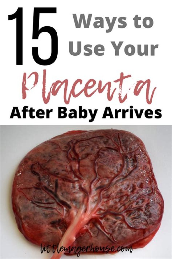 Is delivering the placenta painful?