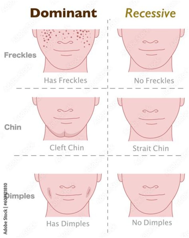 Is freckles a dominant trait?