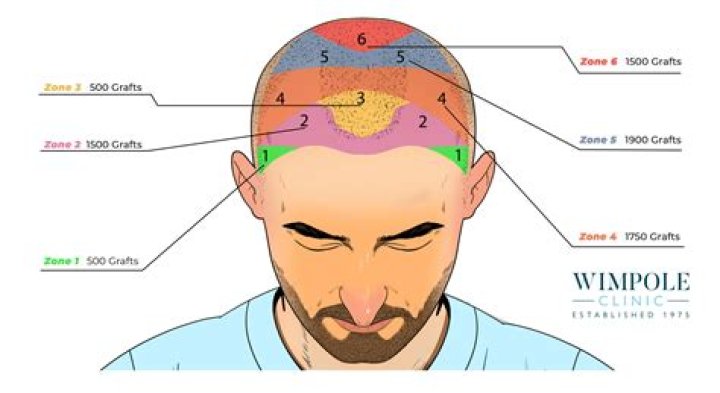 Is hair on your head dead?